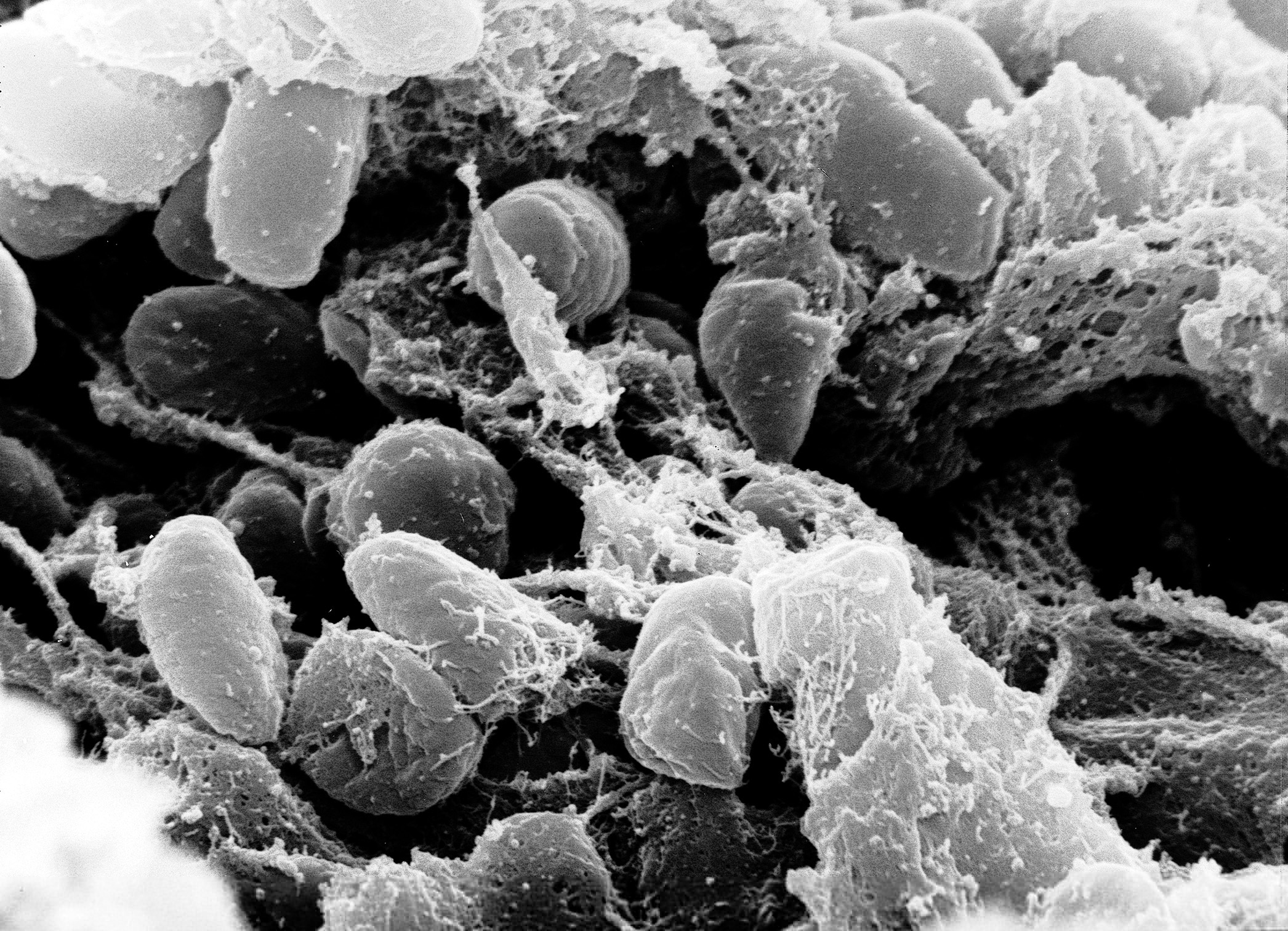 Episode 13: The Black Death In Sweden Podcast Guide